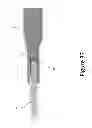 Fig. 38 - PROXIMAL INTERPHALANGEAL FUSION DEVICE