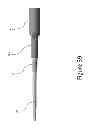 Fig. 40 - PROXIMAL INTERPHALANGEAL FUSION DEVICE