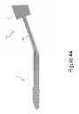Fig. 45 - PROXIMAL INTERPHALANGEAL FUSION DEVICE
