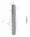 Fig. 48 - PROXIMAL INTERPHALANGEAL FUSION DEVICE