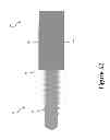 Fig. 53 - PROXIMAL INTERPHALANGEAL FUSION DEVICE