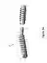 Fig. 55 - PROXIMAL INTERPHALANGEAL FUSION DEVICE