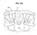 Fig. 07 - Methods and devices for minimally invasive spinal fixation element placement