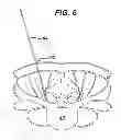 Fig. 09 - Methods and devices for minimally invasive spinal fixation element placement