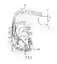 Fig. 02 - System and method for automated adjustment of cardiac resynchronization therapy control parameters