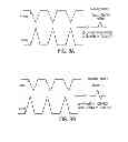 Fig. 04 - System and method for automated adjustment of cardiac resynchronization therapy control parameters