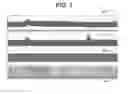 Fig. 07 - Methods and apparatus for treating anaphylaxis using electrical modulation