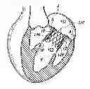 Fig. 01 - Prosthetic valve for replacing mitral valve