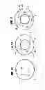 Fig. 04 - Prosthetic valve for replacing mitral valve