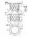 Fig. 06 - Prosthetic valve for replacing mitral valve