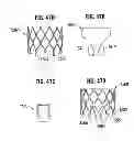 Fig. 20 - Prosthetic valve for replacing mitral valve