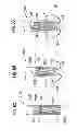 Fig. 29 - Prosthetic valve for replacing mitral valve
