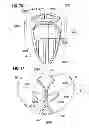 Fig. 34 - Prosthetic valve for replacing mitral valve
