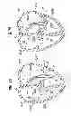Fig. 35 - Prosthetic valve for replacing mitral valve