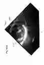 Fig. 45 - Prosthetic valve for replacing mitral valve
