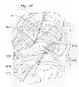 Fig. 48 - Prosthetic valve for replacing mitral valve