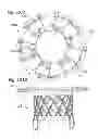 Fig. 50 - Prosthetic valve for replacing mitral valve