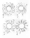 Fig. 52 - Prosthetic valve for replacing mitral valve