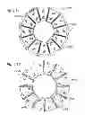 Fig. 56 - Prosthetic valve for replacing mitral valve