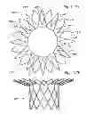 Fig. 58 - Prosthetic valve for replacing mitral valve