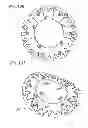 Fig. 64 - Prosthetic valve for replacing mitral valve