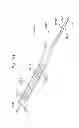 Fig. 71 - Prosthetic valve for replacing mitral valve