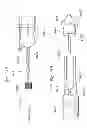 Fig. 72 - Prosthetic valve for replacing mitral valve