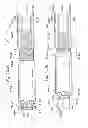 Fig. 79 - Prosthetic valve for replacing mitral valve