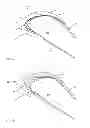 Fig. 06 - Implant and implant system
