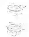 Fig. 09 - Vertebral body replacement device and method for use to maintain a space between two vertebral bodies within a spine