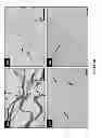 Fig. 06 - IMPLANTABLE INTERVERTEBRAL DISC DEVICES AND USES THEREOF