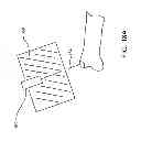 Fig. 22 - Method for detecting a disturbance as an energy applicator of a surgical instrument traverses a cutting path