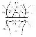 Fig. 01 - Systems and methods for determining the mechanical axis of a femur