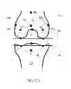 Fig. 03 - Systems and methods for determining the mechanical axis of a femur
