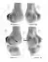 Fig. 06 - Systems and methods for determining the mechanical axis of a femur