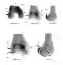 Fig. 07 - Systems and methods for determining the mechanical axis of a femur