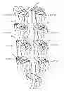 Fig. 20 - Systems and methods for determining the mechanical axis of a femur