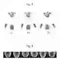 Fig. 03 - SPEECH RECOGNITION LEARNING METHOD USING 3D GEOMETRIC INFORMATION AND SPEECH RECOGNITION METHOD USING 3D GEOMETRIC INFORMATION