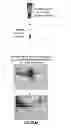 Fig. 02 - A2M FRAGMENTS AND APPLICATIONS THEREOF