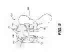Fig. 07 - ATTACHMENT DEVICES