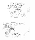 Fig. 09 - METHOD AND APPARATUS FOR ADJUSTING THE FIT AND APPEARANCE OF AN ARTICLE OF APPAREL