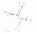 Fig. 11 - METHOD AND APPARATUS FOR ADJUSTING THE FIT AND APPEARANCE OF AN ARTICLE OF APPAREL