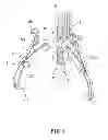 Fig. 02 - PULLER