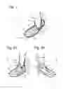 Fig. 02 - Assembly comprising a shoe, a shaped piece connected with the shoe to support the ankle, and a set of a shaped piece and fixing means for attachment to the shoe