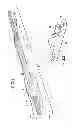 Fig. 02 - Device for locking and unlocking an elongate tubular element