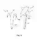 Fig. 06 - Implant specific drill bit