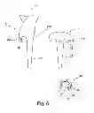 Fig. 07 - Implant specific drill bit