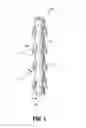 Fig. 02 - Compound barb medical device and method