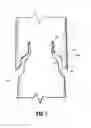 Fig. 09 - Compound barb medical device and method