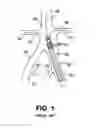 Fig. 02 - Method of making a conduit for interventional procedures
